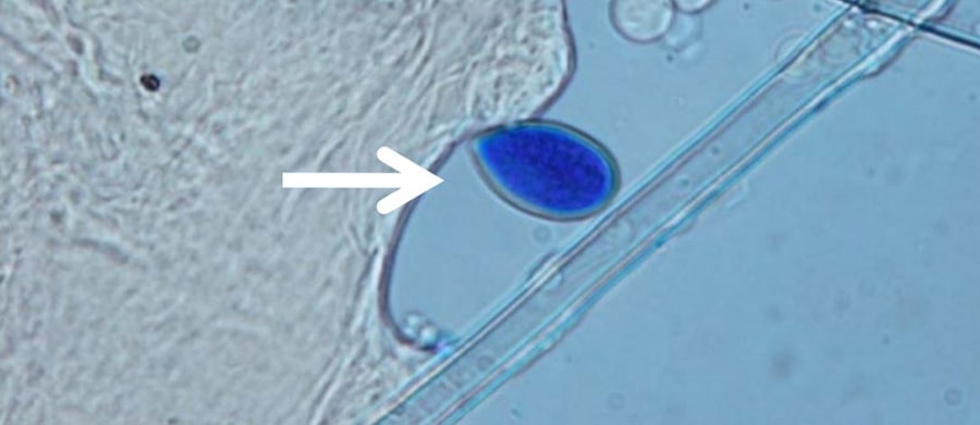 view of pathogen in microscope